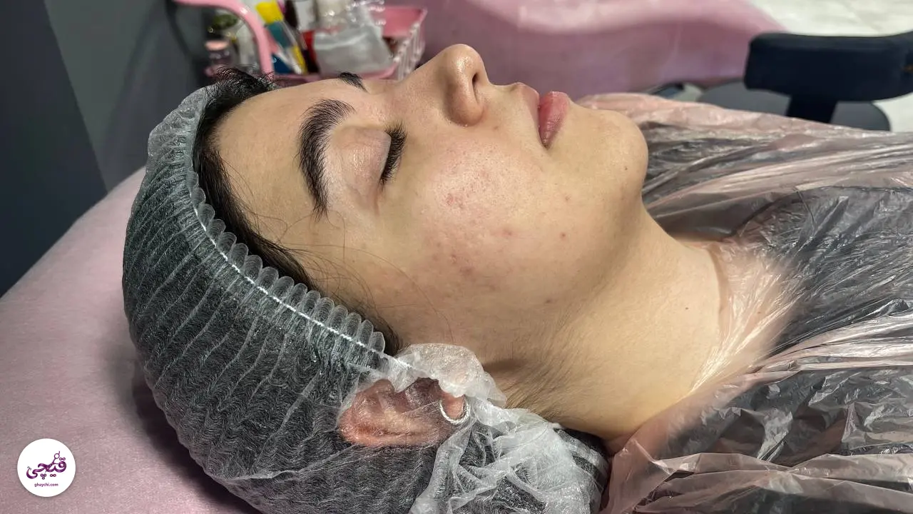قبل پوست — فیشیال صورت در کرج، کرج — تارا امینی ثابت